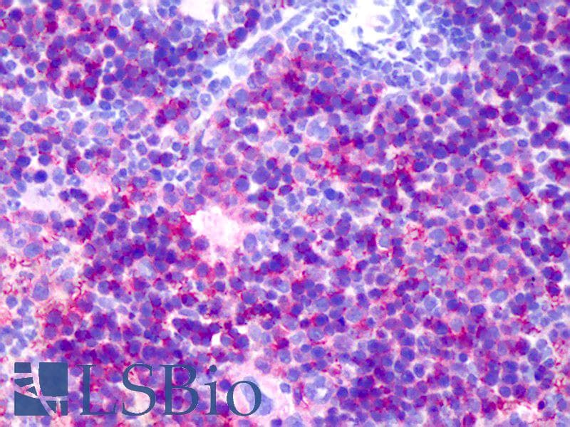 IHC-plus™ Monoclonal Rat anti-Mouse Basigin / Emmprin / CD147 Antibody (IHC, WB)