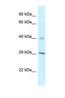RCC1 Antibody (C-Terminus)