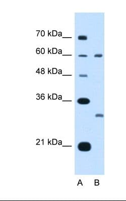 Polyclonal Rabbit anti-Human TSPAN32 / PHEMX Antibody (FITC, aa101-150, IHC, WB)