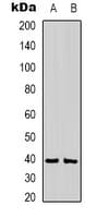 Polyclonal Rabbit anti-Mouse CABP / CABP1 Antibody (IHC, WB)