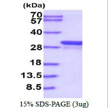 Human GSTT1 Protein (Recombinant His)