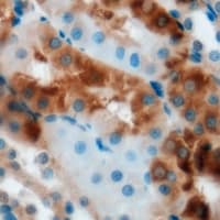 Polyclonal Rabbit anti-Human GLO1 / Glyoxalase I Antibody (IHC, WB)