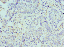 ARG2 / Arginase 2 Antibody (aa1-354)