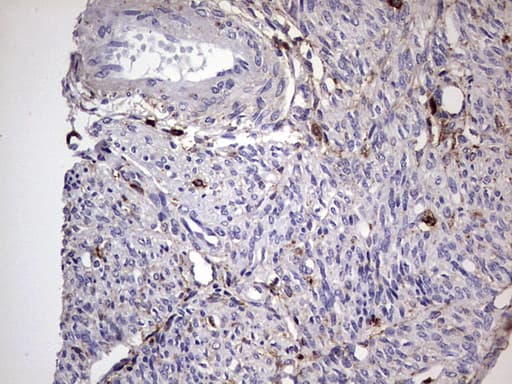 Monoclonal Mouse anti-Human CD63 Antibody (clone OTI5E5, IHC, WB)