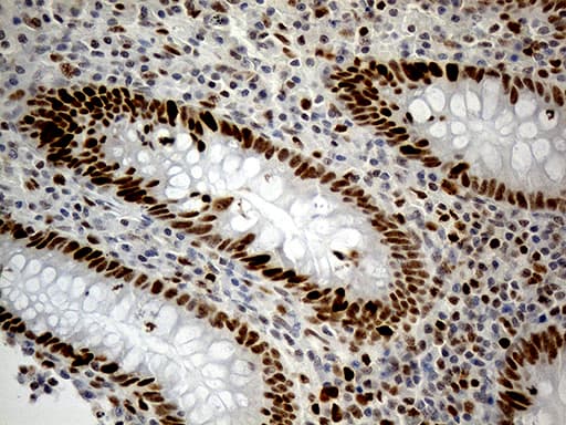 Monoclonal Mouse anti-Human RB1 / Retinoblastoma / RB Antibody (clone OTI11C10, aa309-590, IHC, WB)