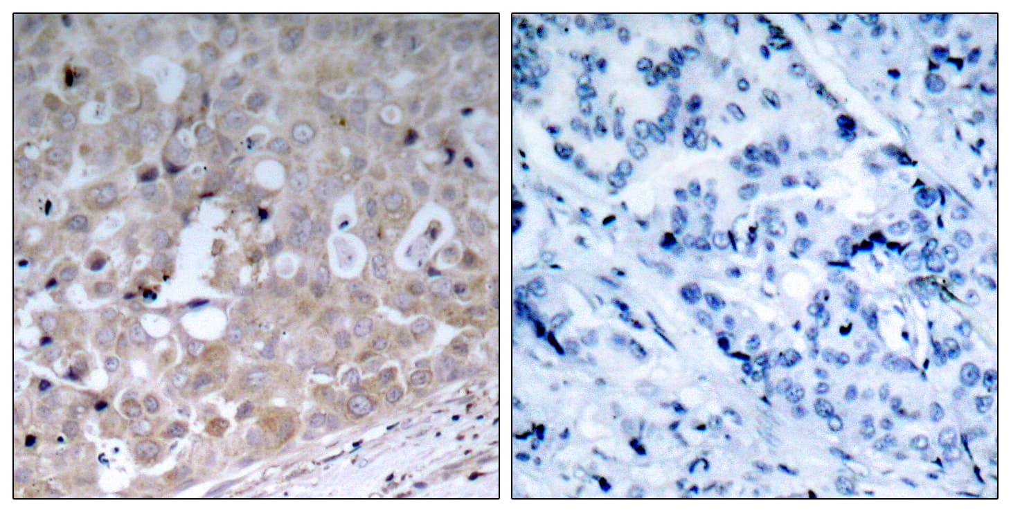 KDR / VEGFR2 / FLK1 Antibody (aa1141-1190)