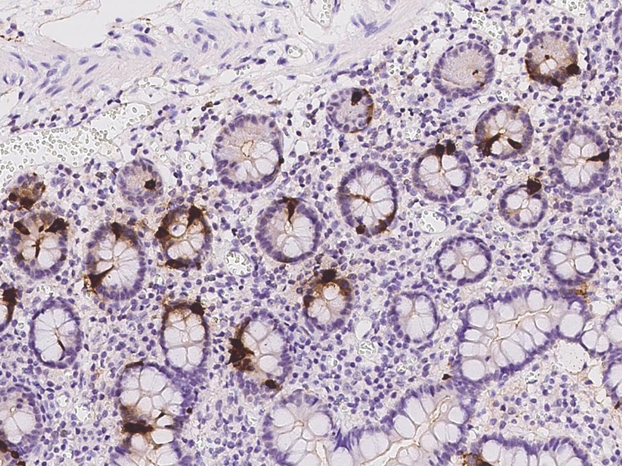 CHGA / Chromogranin A Antibody