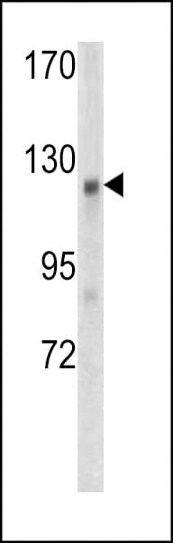 FAM123B / WTX Antibody (aa681-708)
