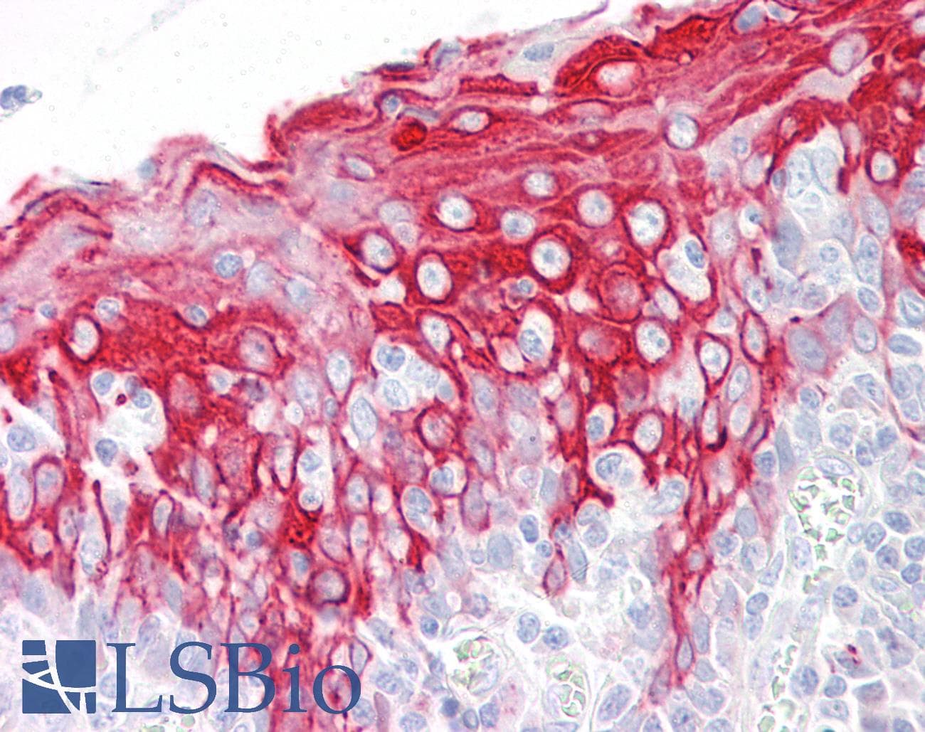 IHC-plus™ KRT16 / CK16 / Cytokeratin 16 Antibody (aa421-470)