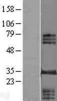 Human INO80E Protein (Over-Expression Lysate Myc-DDK (Flag))