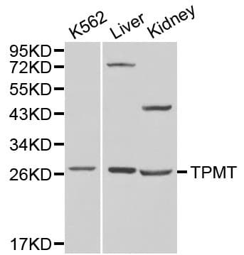 TPMT Antibody