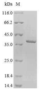 E. coli Outer Membrane Protein C (Recombinant)