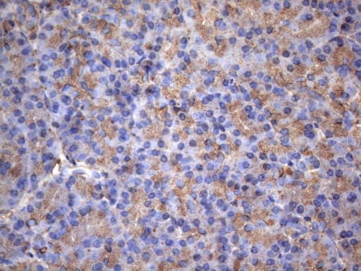 Monoclonal Mouse anti-Human MAP3K8 / TPL2 Antibody (clone OTI2E3, aa277-461, IHC, WB)