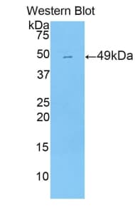 NR1I2 / PXR Antibody (aa205-390, Biotin)