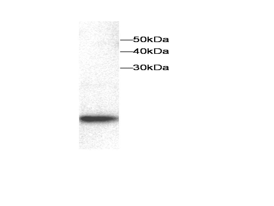 IHC-plus™ Monoclonal Mouse anti-Human IL8 / Interleukin 8 Antibody (clone 5D8, IHC, WB)