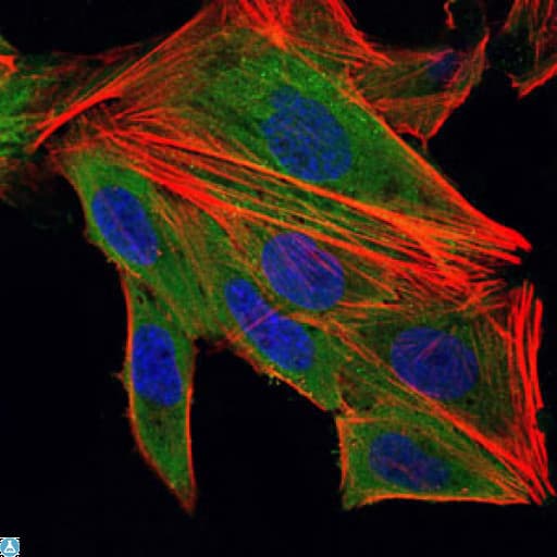IL-1B / IL-1 Beta Antibody