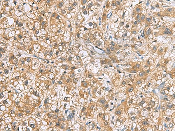 Polyclonal Rabbit anti-Human C6orf108 Antibody (IHC, WB)
