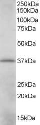 IHC-plus™ CRKL Antibody (aa292-303)