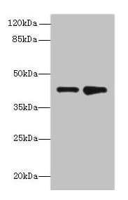 IHC-plus™ Polyclonal Rabbit anti-Human ELAVL4 / HuD Antibody (IHC, IF, WB)