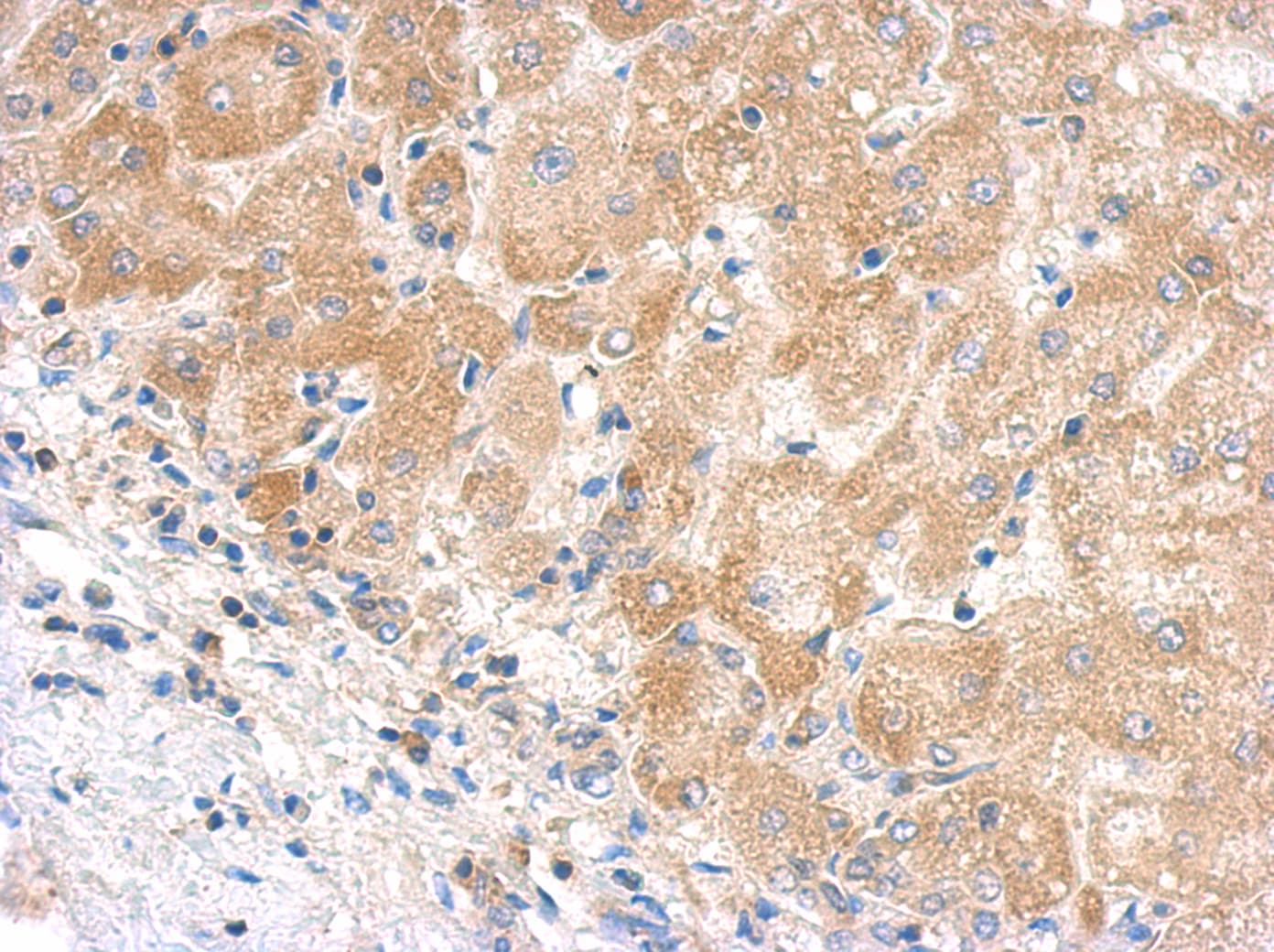 Polyclonal Rabbit anti-Human Complement C5 Antibody (aa1223-1451, IHC, WB)