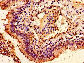 HIST1H1E Antibody