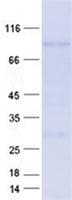 Human RAG2 / RAG-2 Protein (Recombinant GST, N-terminus + His, C-terminus)