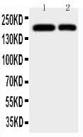 ITGAM / CD11b Antibody (aa177-192)