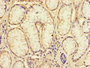 NRIP3 Antibody