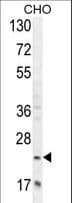 Polyclonal Rabbit anti-Human RILPL2 Antibody (aa120-149, IHC, WB)