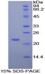 Human CD110 / MPL Protein (Recombinant His-T7)