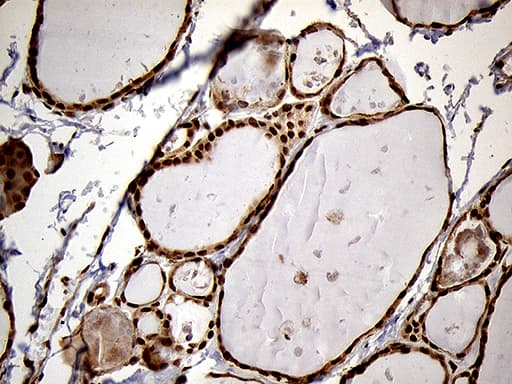 MEIS1 Antibody (aa176-390, clone OTI3G8)