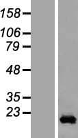 CCDC12 Protein (Over-Expression Lysate Myc-DDK (Flag))