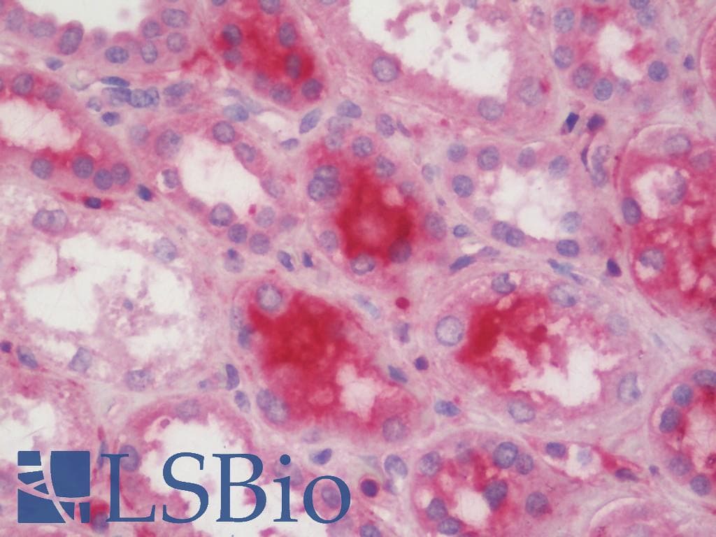 IHC-plus™ Polyclonal Rabbit anti-Human DCTN1 / Dynactin 1 Antibody (aa1216-1278, IHC, WB)