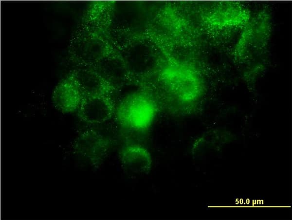 ITGA2 / CD49b Antibody (clone 2B6)