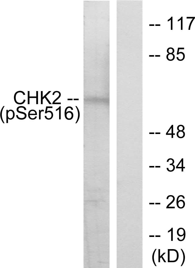 Polyclonal Rabbit anti-Human CHEK2 / CHK2 Antibody (phospho-Ser516, WB)