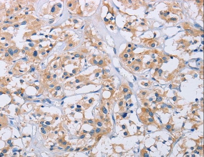 CCR9 / CD199 Antibody