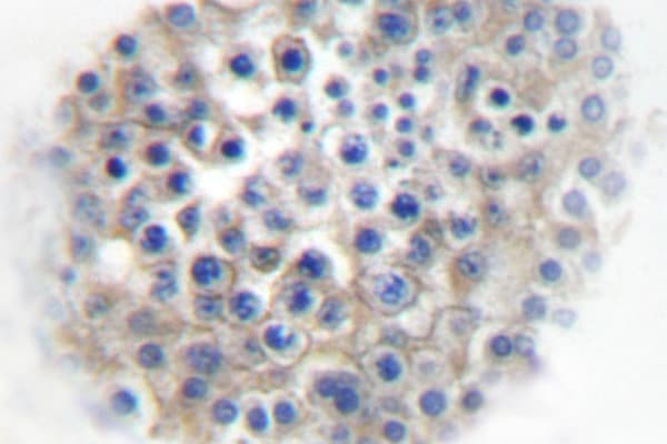 ADRA2A Antibody (Arg361)