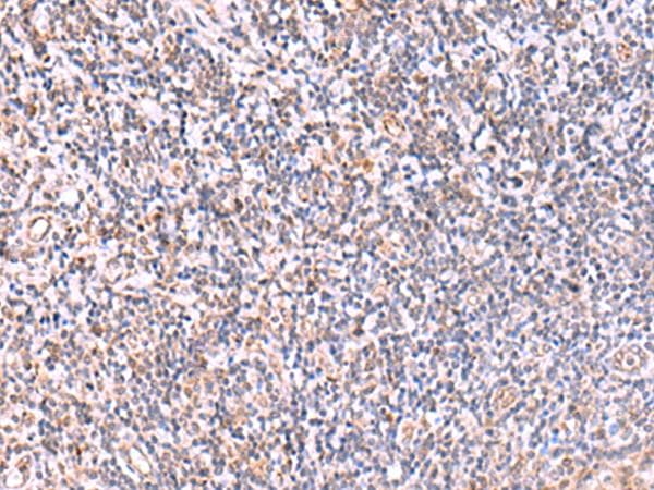 ITPKC Antibody