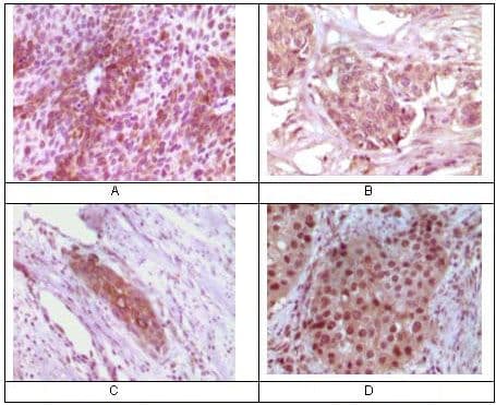 Monoclonal Mouse anti-Human RAB25 Antibody (clone 3F12F3, IHC, WB)