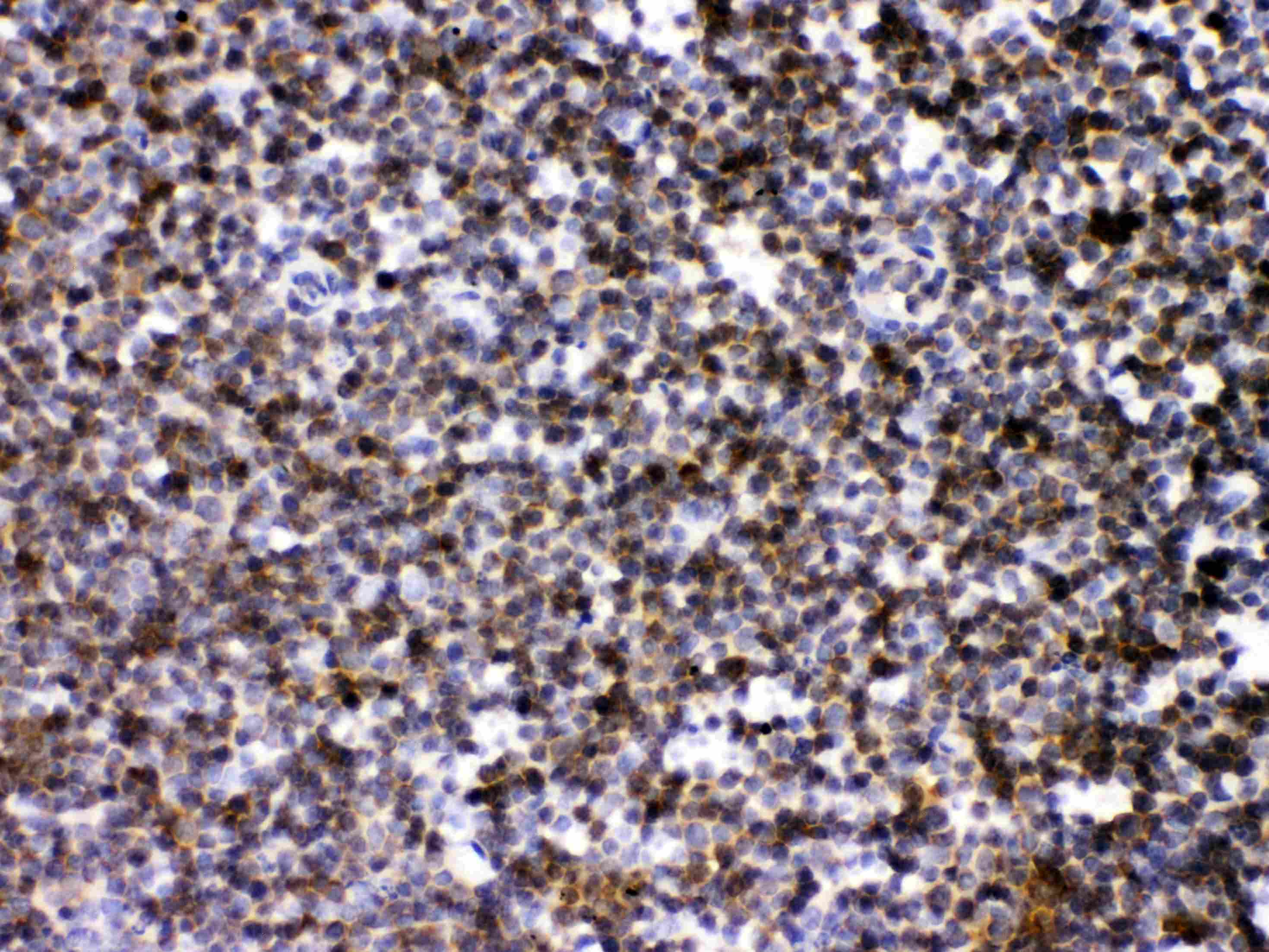 ARHGEF1 Antibody