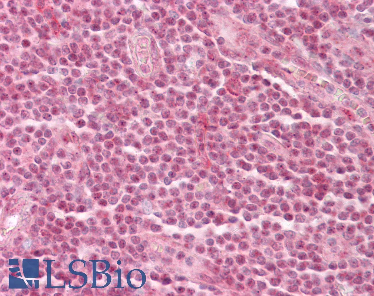 IHC-plus™ GATAD2A Antibody (aa137-150)