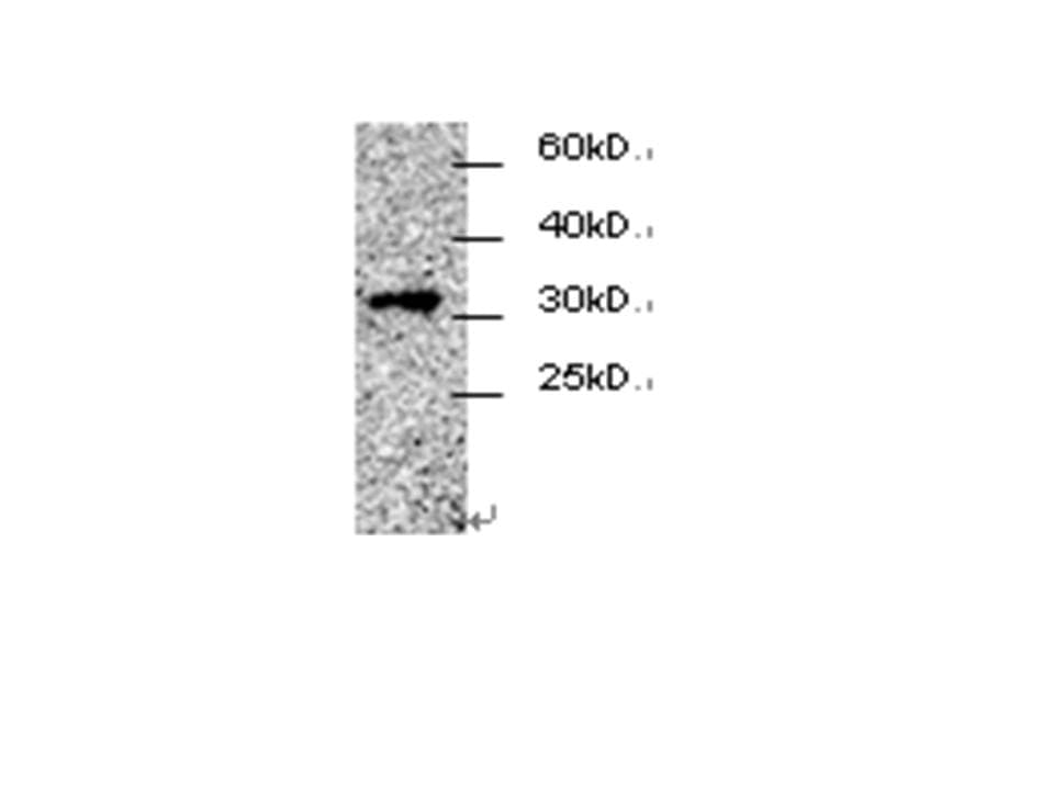 CDCA4 Antibody