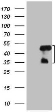 Monoclonal Mouse anti-Human MRPL15 Antibody (clone OTI2D3, Carrier-free, aa28-296, WB)