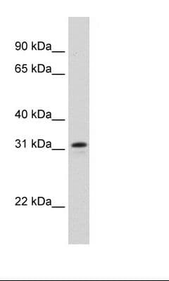 NIFK / MKI67IP Antibody (aa140-189)