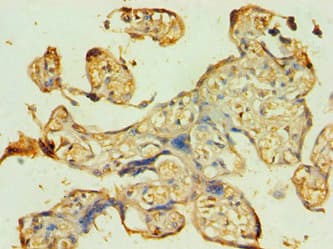 Polyclonal Rabbit anti-Human ATG9B Antibody (aa715-924, IHC)