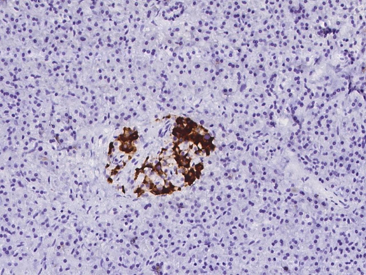 Polyclonal Rabbit anti-Human MAP1B Antibody (IHC)