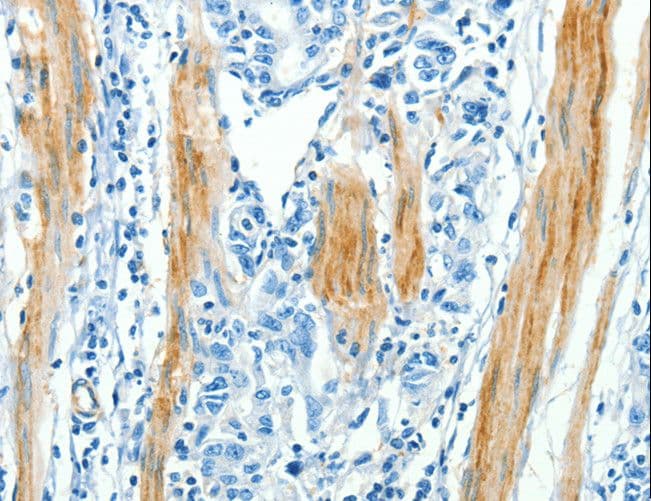Polyclonal Rabbit anti-Human CAV3 / Caveolin 3 Antibody (IHC, WB)