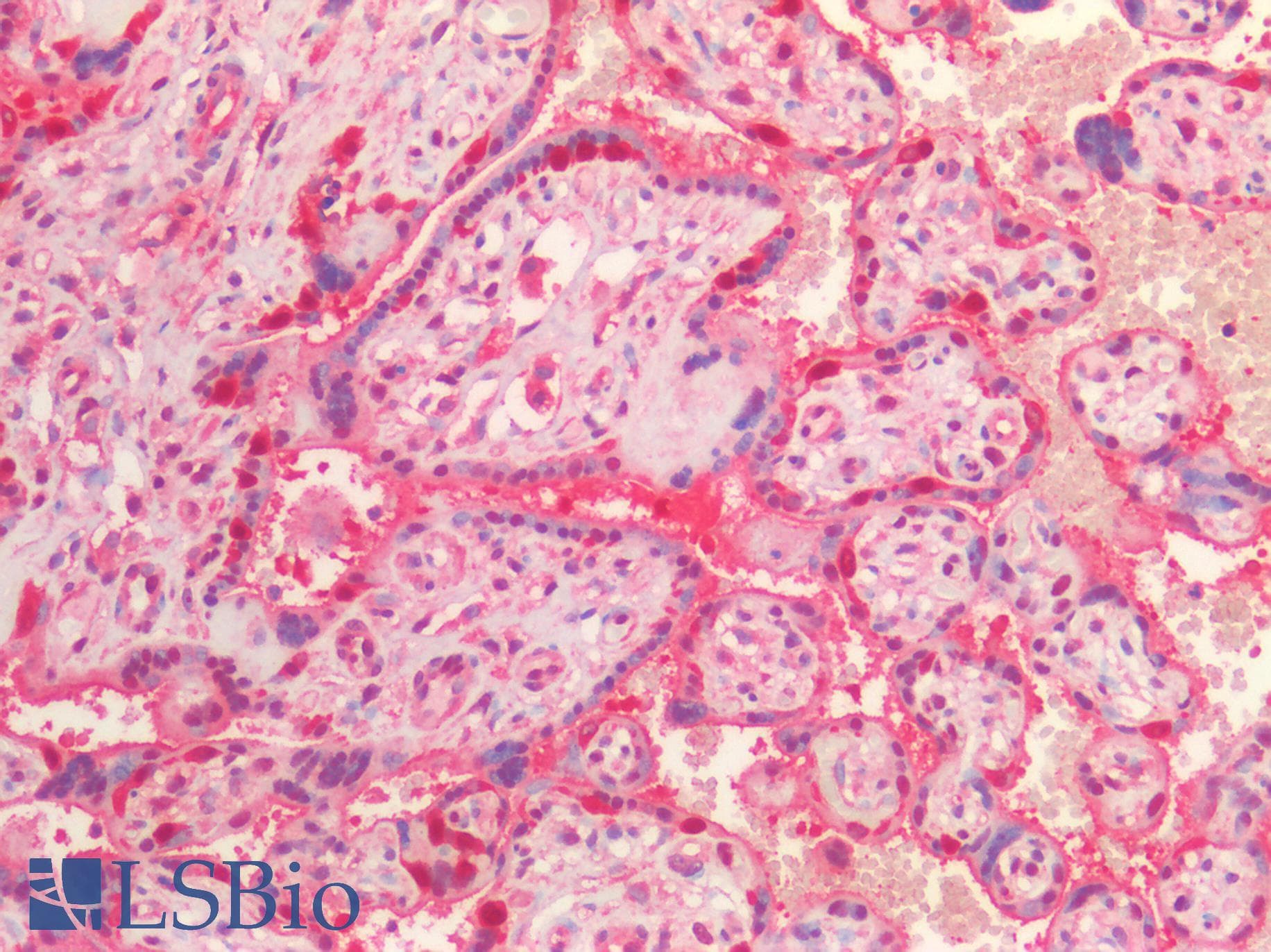 IHC-plus™ VCP Antibody (Internal Region)