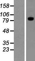 ADAM15 Protein (Over-Expression Lysate Myc-DDK (Flag))