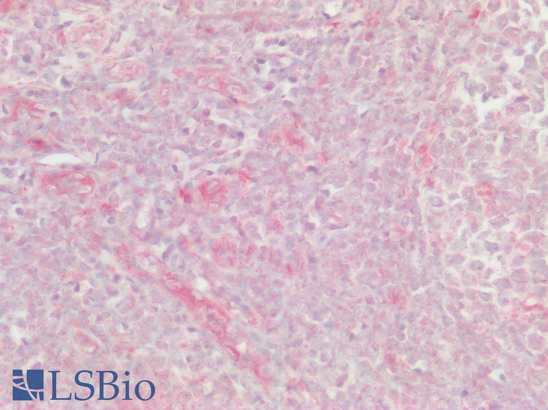 IHC-plus™ XCR1 Antibody (Cytoplasmic Domain)